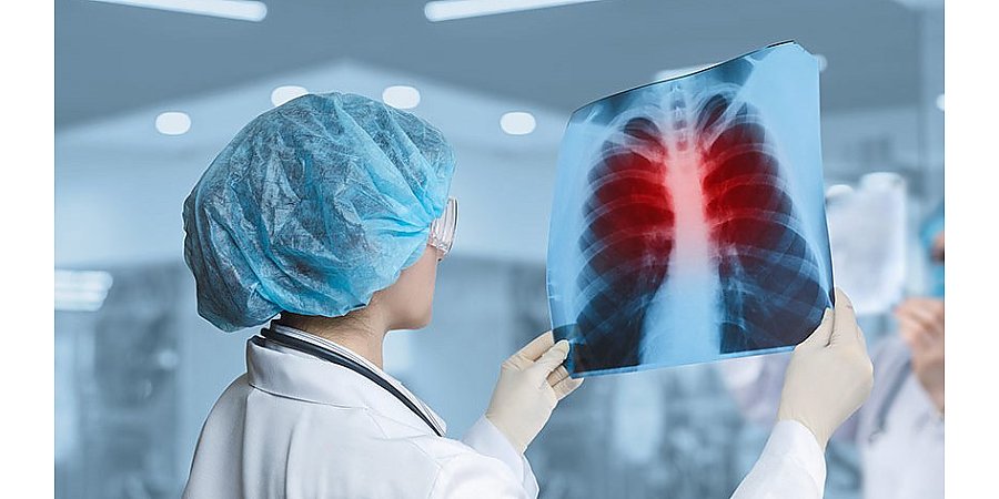 ТУБЕРКУЛЕЗ: проблема все еще актуальна