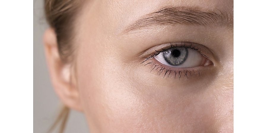 Из-за чего могут отекать веки? Офтальмолог назвала возможные причины